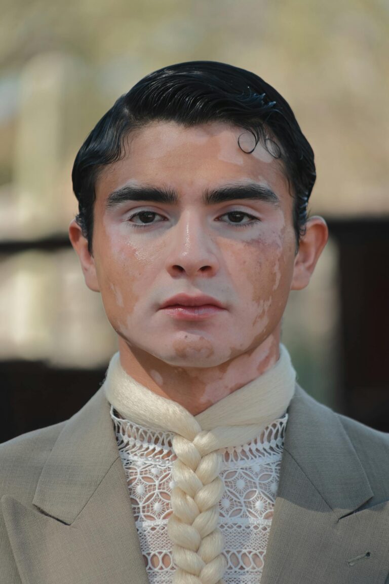 How To Get Rid of White Patches On Face