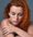 Which Vitamin Deficiency Causes White Patches on the Face